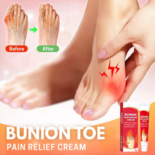 Bunion Toe Relief Cream